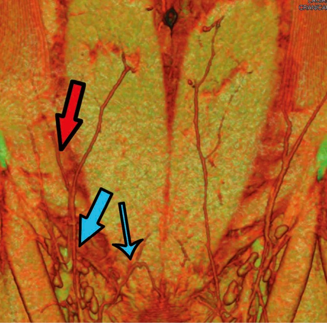 Figure 14