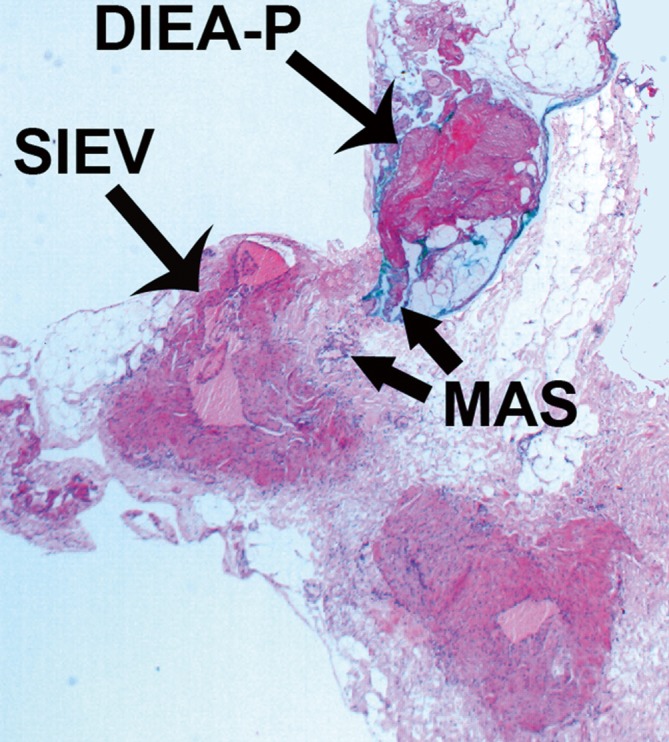 Figure 22