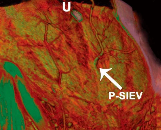 Figure 17