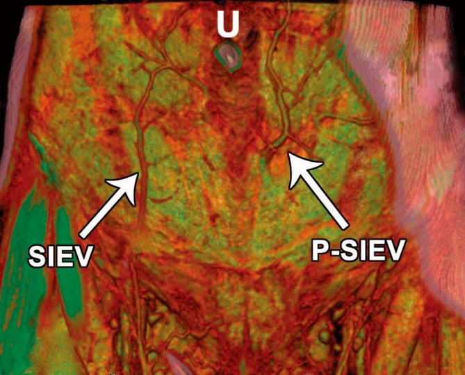 Figure 16