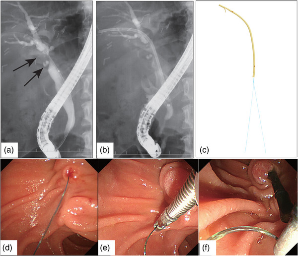 FIGURE 1