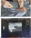 Fig. 4: