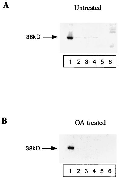 FIG. 11