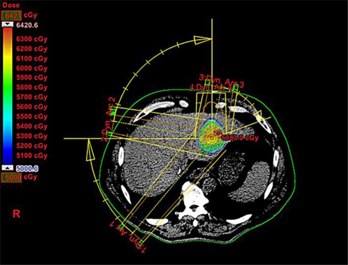 Fig. 1