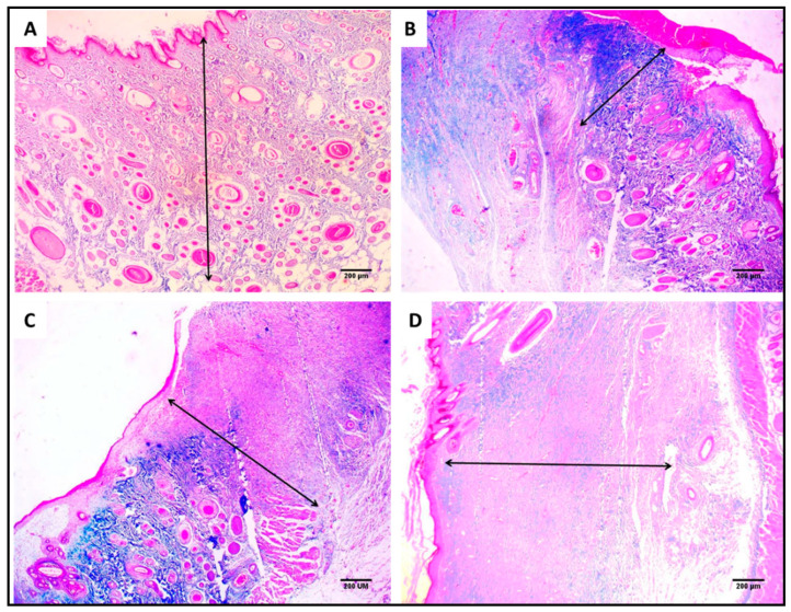 Figure 14