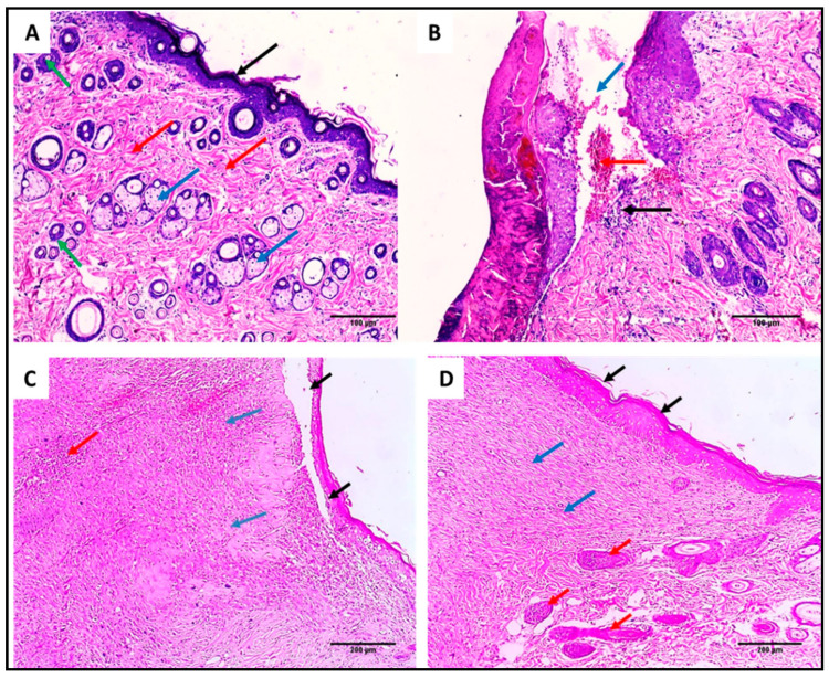 Figure 13