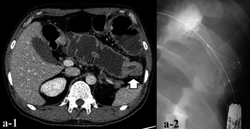 Fig. 1