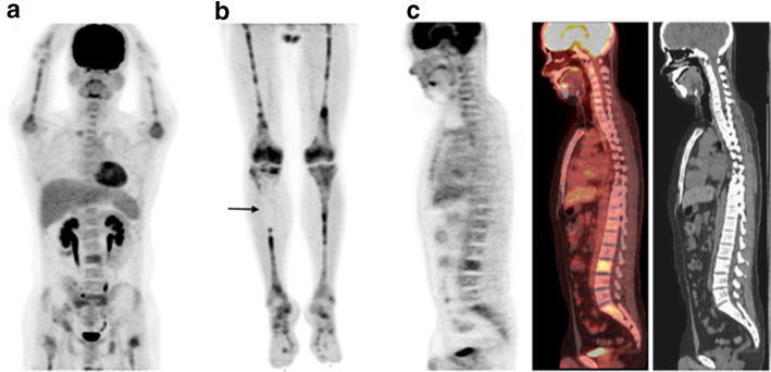 Fig. 1