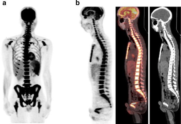 Fig. 2