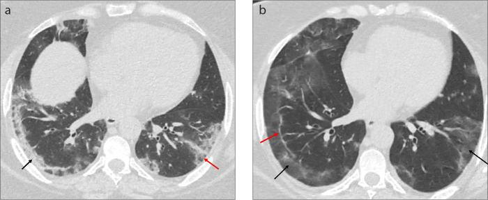 Figure 18. a, b