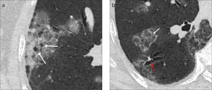 Figure 12. a, b