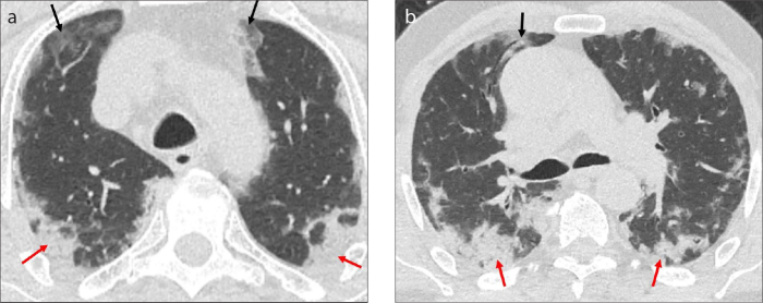 Figure 4. a, b