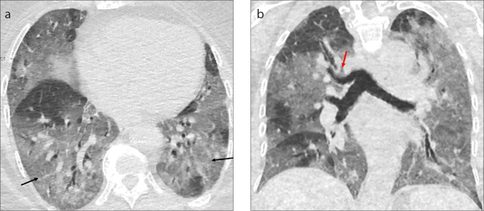 Figure 19. a, b