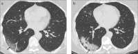 Figure 16. a, b