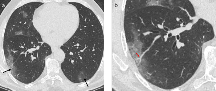 Figure 10. a, b