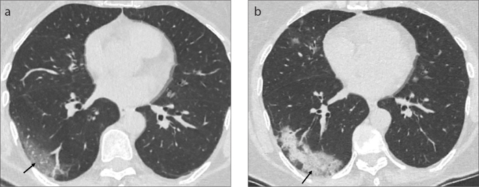 Figure 16. a, b