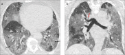Figure 19. a, b