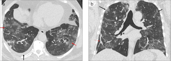 Figure 20. a, b