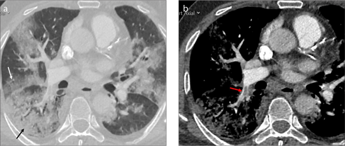 Figure 15. a, b