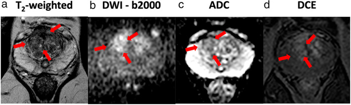 FIGURE 4