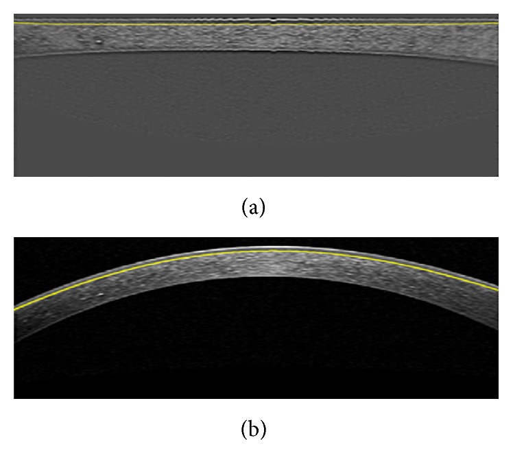 Figure 15