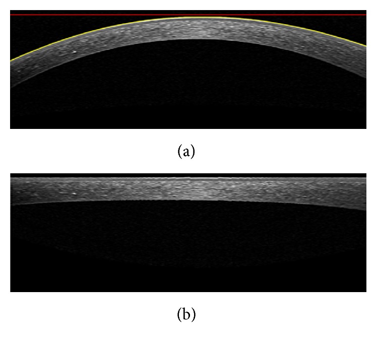 Figure 13