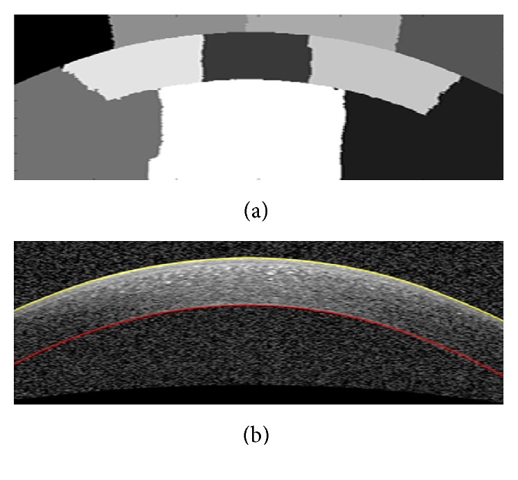 Figure 12