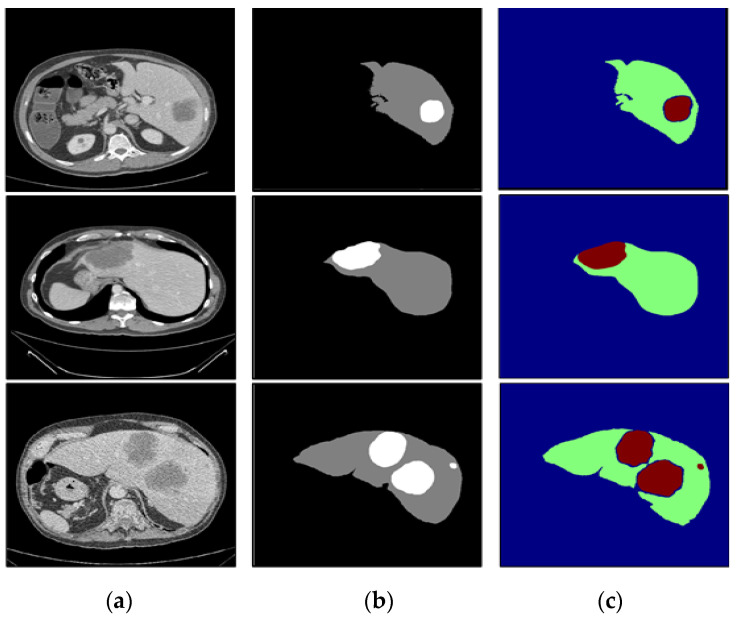 Figure 11