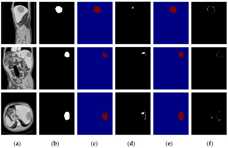 Figure 14