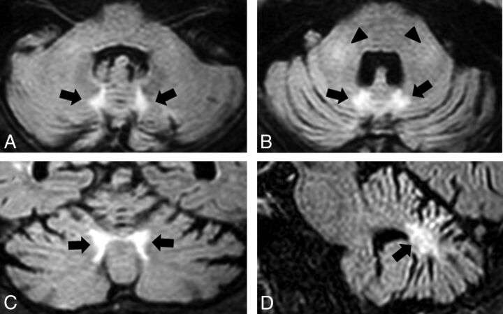 Fig 1.