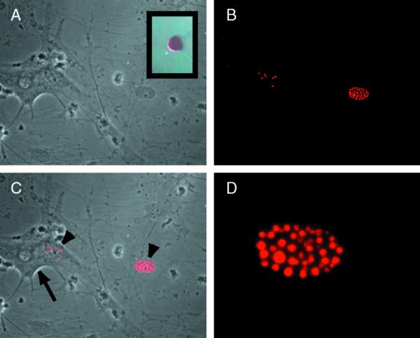 FIG. 1