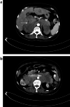 Fig. 4