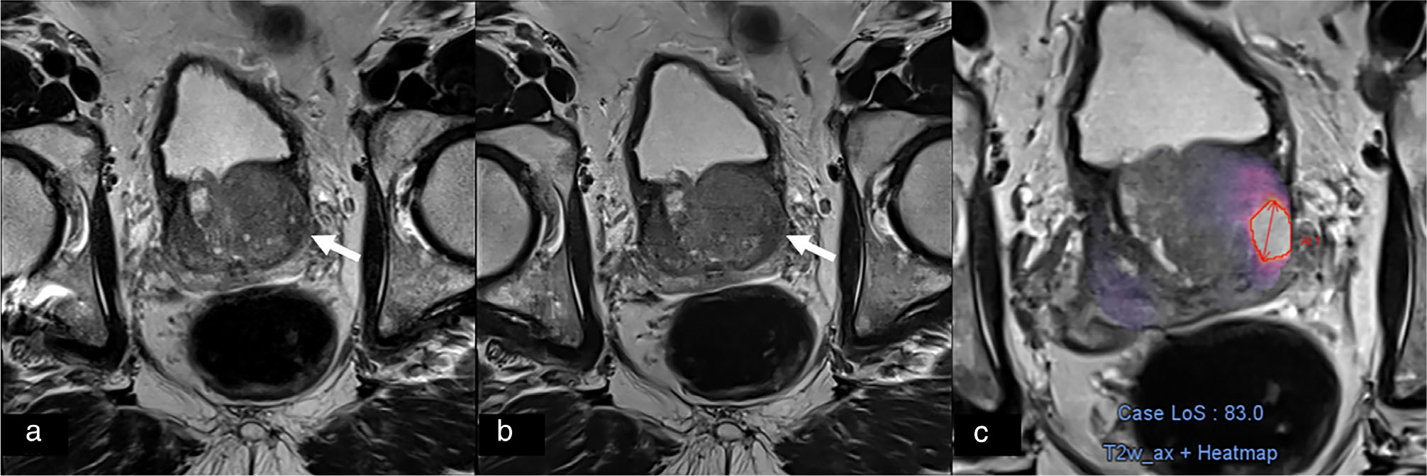 FIGURE 3: