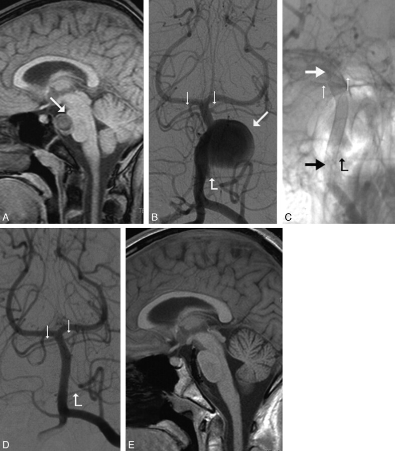 Fig 3.