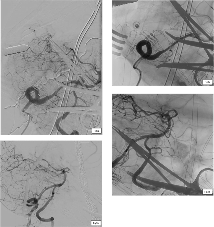 Fig. 3