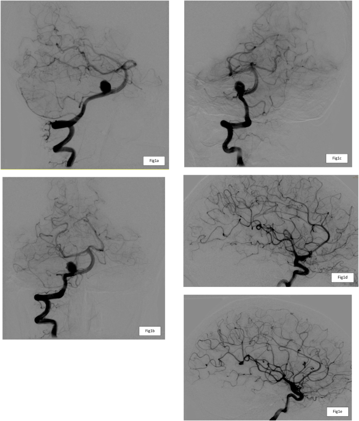 Fig. 1