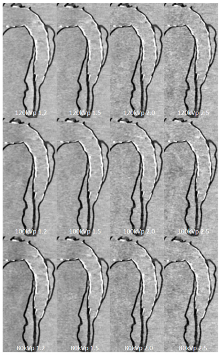 Figure 14