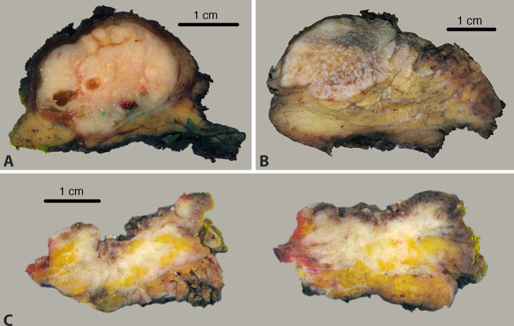 Fig.4