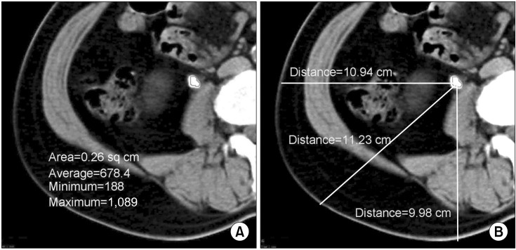 FIG. 1