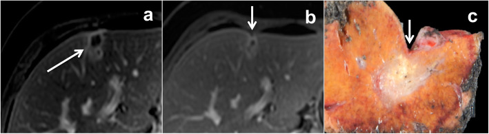 Fig. 11
