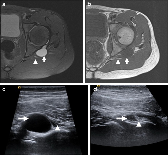 Fig. 12