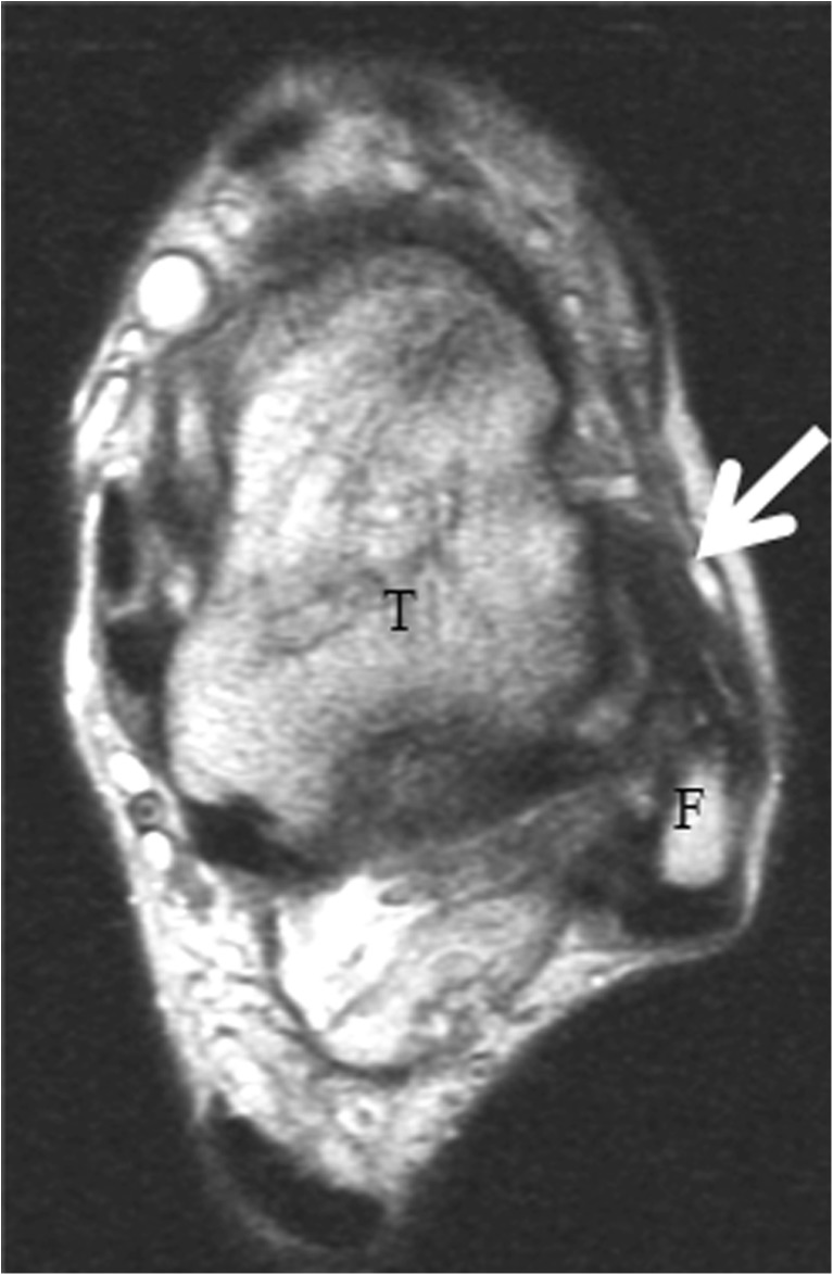 Fig. 5