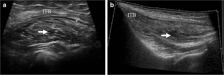 Fig. 13