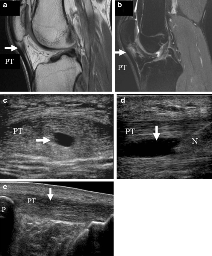 Fig. 15