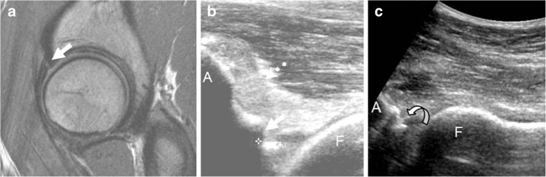 Fig. 11