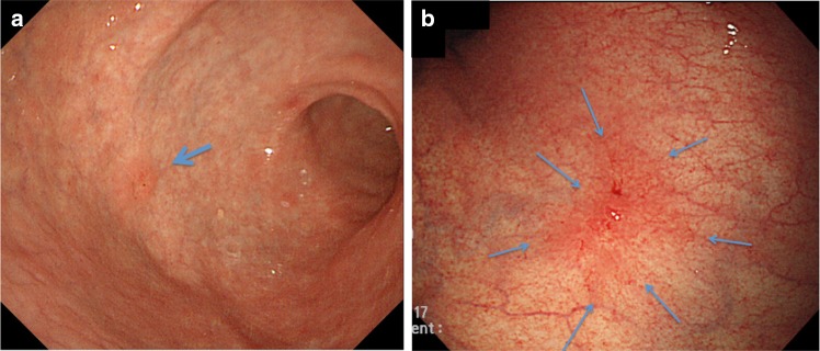 Fig. 6a–b