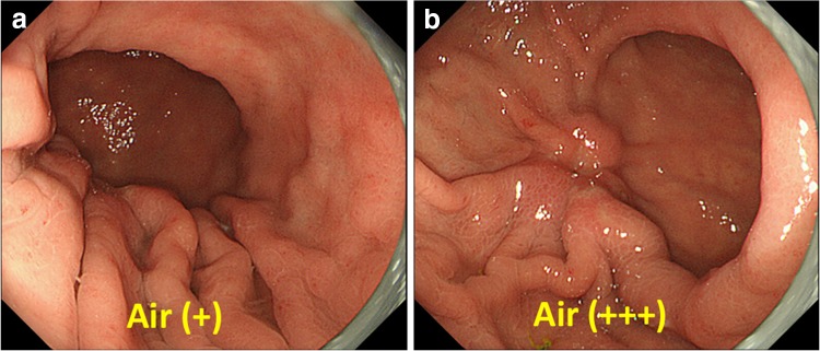 Fig. 1a–b