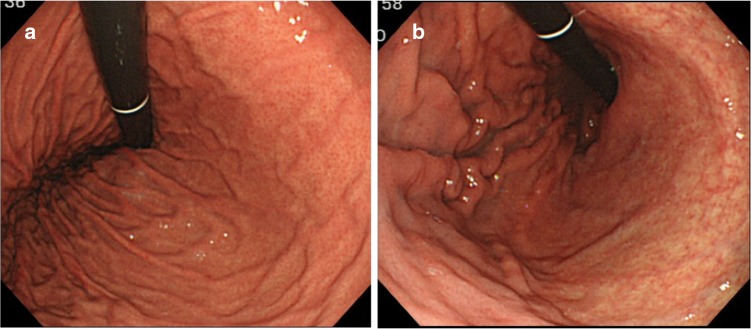 Fig. 4a–b