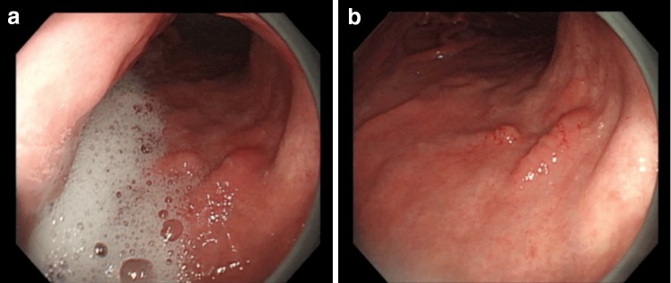 Fig. 2a–b