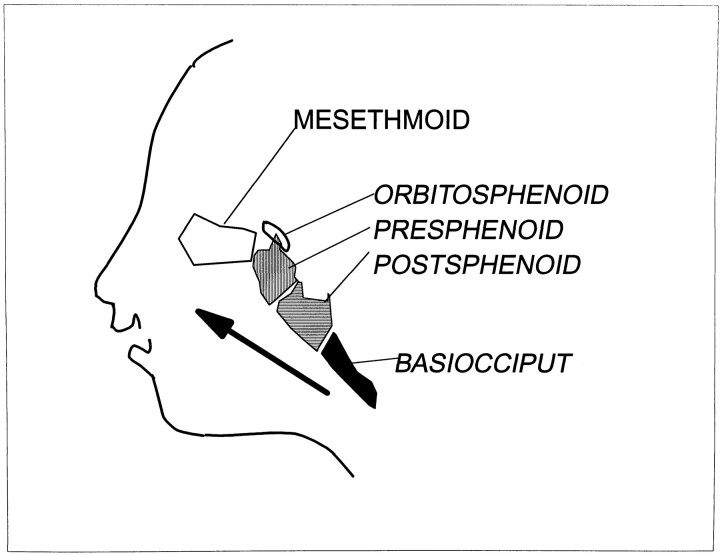 fig 13.